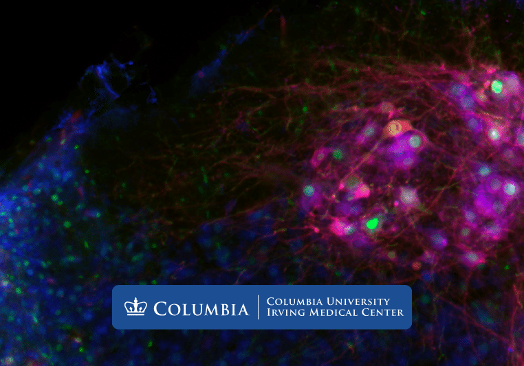 Columbia Will Making Neurons Young Again Stop ALS